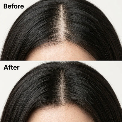 Root Ritual Scalp Bar: The Botanical Shampoo Bar for Clean Roots and a Lighter-Feeling Finish